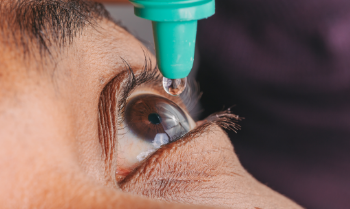 10 Best Treatments for Dry Eye Relief